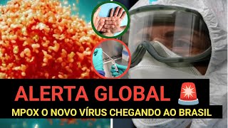 Mpox vírus que está chegando ao Brasil quot Sintomas e prevenção [upl. by Henden]