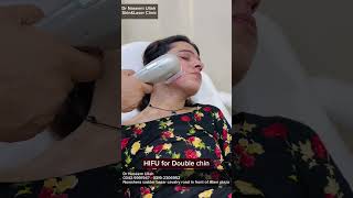 Hifu treatment by Dr Naseemullah dermatologist [upl. by Cumine]