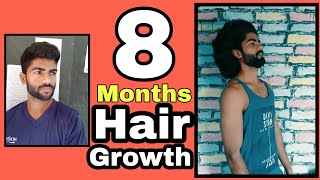 Hair growth update video  8 Months hair growth  Boys long hair [upl. by Arata]