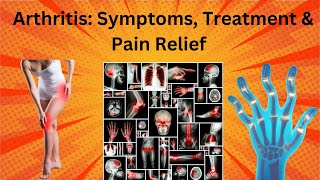 Arthritis symptoms treatment amp pain relief [upl. by Picker]