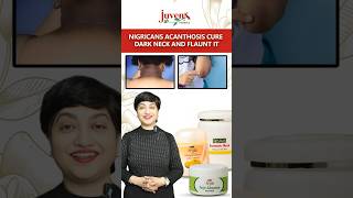 Nigricans Acanthosis Cure Dark Neck And Flaunt It  Juvena Herbals [upl. by Assiluy]