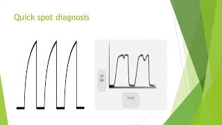 Capnography in Anaesthesia and Critical Care [upl. by Ahsirk]