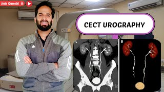 CECT Urography with Fliming  By Anis Qureshi [upl. by Ebonee210]