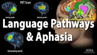 Language Pathways and Aphasia Animation [upl. by Sinnylg573]