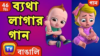 ব্যথা লাগার গান The Boo Boo Song  More Bangla Rhymes for Children  ChuChu TV [upl. by Hobie]