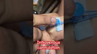 Intravenous cannula fix  shorts yrendingshortsonyoutube doctor trending SMpharmacy [upl. by Iphagenia483]