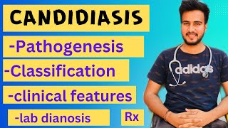 Candidiasis microbiologypathogenesislabdiagnosisTreatment [upl. by Eldnek]