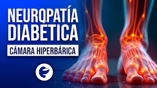 Neuropatía Diabética [upl. by Onitnatsnoc]