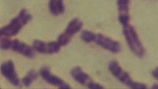 Cytogenetics Human chromosomes Karyotype [upl. by Ojibbob]