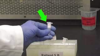 Triglyceride Determination [upl. by Lilybelle]