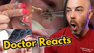 Dermatologists Reaction to Viral Pimple Popping Cyst Popping TikToks [upl. by Enimasaj]