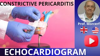 How to Escape the Grip of Constrictive Pericarditis Echocardiography Diagnose [upl. by Occor]