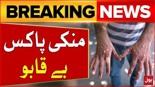 Monkeypox Cases Increasing in Pakistan  Alert Issued  Breaking News [upl. by Ahseer]