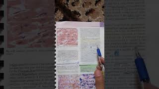 Pathological calcification  Robbins Pathology  3rd Year MBBS [upl. by Alejandra]