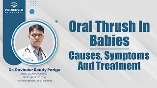 Oral Thrush In Babies Causes Symptoms And Treatment  Medicover Hospitals [upl. by Ermeena]