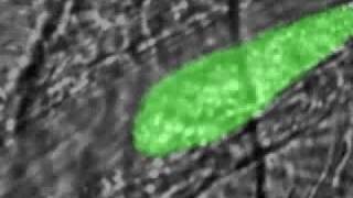 Real time thrombus formation after a laserinduced injury [upl. by Adama480]