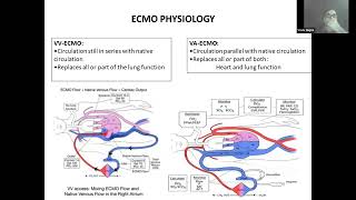 01 Ventilation strategy during ECMO by Dr Vivek Gupta ECMO INDIA OCT 2024  Day 02 [upl. by Athal]