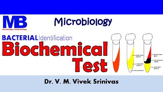 BIOCHEMICAL TEST  Bacterial Identification Technique  Microbiology  Vivek Srinivas Bacteriology [upl. by Arahas]