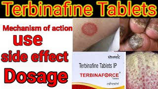 Terbinafine Tablets IP 250mg500mg in hindi Mechanism of action side effects dose [upl. by Oniram]