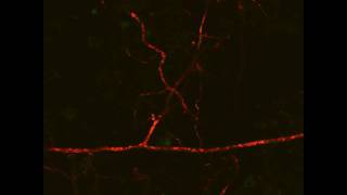 Arbuscular Mycorrhizal Symbiosis extraradical lipid flow 1 Live Imaging [upl. by Aikenahs]