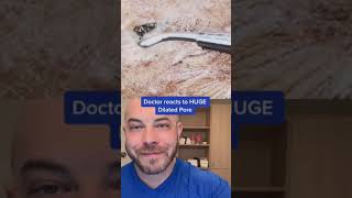 Doctor reacts to massive dilated pore blackhead pimplepop dermreacts doctorreacts [upl. by Girard275]