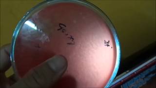 Estreptococos BHemolíticos en Cultivo Agar Sangre [upl. by Atiral]