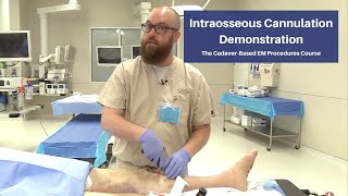 Intraosseous Cannulation Demonstration  The CadaverBased EM Procedures SelfStudy Course [upl. by Antoinette205]