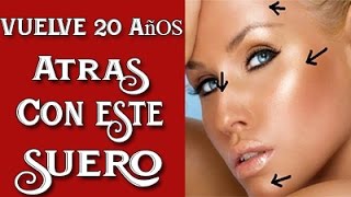 Suero Vitamínico Casero para rejuvenecer cualquier parte de tu piel [upl. by Timus595]