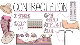 Methods of Contraception Made Easy Contraceptive Methods Explained [upl. by Perkoff]