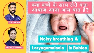 Noisy breathing in babies Causes and remedies in Hindi  Laryngomalacia [upl. by Jueta147]