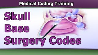 CPT Coding Guidelines — Skull Base Surgery Codes [upl. by Ecerehs]