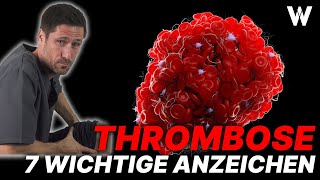 Lebensgefahr Thrombose 7 Warnzeichen und wichtige Tipps gegen Thrombosen [upl. by Enneicul167]