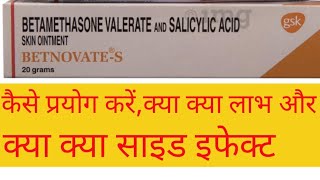 Betnovate S  Betamethasone Valerate amp Salicylic Acid Use Profit and sideeffective in Hindi [upl. by Messere570]