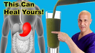 This Juice Healed My STOMACH amp GUTIt Can Heal Yours Dr Mandell [upl. by Halfon898]