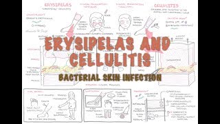 Bacterial Skin Infection  Cellulitis and Erysipelas Clinical Presentation Pathology Treatment [upl. by Ettenaej]