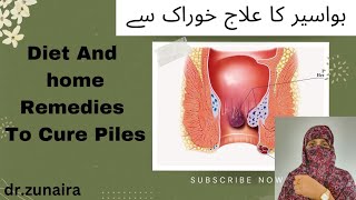 Management and treatment of piles  piles ka ilaj ghar ma  hemorrhoids [upl. by Shanley523]