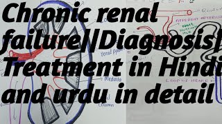 Chronic renal failureDiagnosisTreatment in HindiUrdu in detail [upl. by Lilahk]