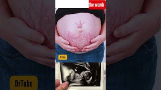 baby in 36 week in mother womb  baby in the womb 37 weeks development baby belly pregnancy [upl. by Oribelle]