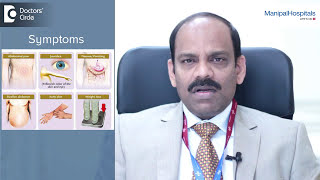 What Is The Prognosis For Liver Cancer Best Hepatologist In India  Dr Olithselvan  Manipal [upl. by Edveh]