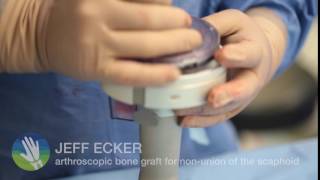 preparation of iliac crest bone graft [upl. by Sherar]