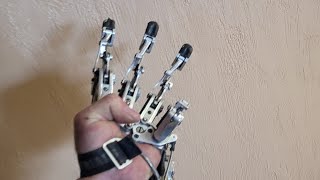 3D Printed Prosthetic Hand DIY Video No3 Making a Check socket [upl. by Haridan]