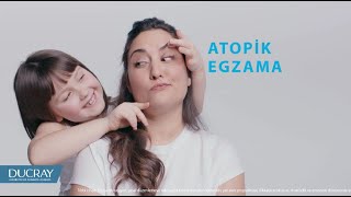 Atopik Egzama Tedavisine Yardımcı DexyaneMed Krem [upl. by Prouty537]