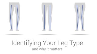 iWALK30 amp 20 Support  Identify Your Leg Type [upl. by Olsewski]