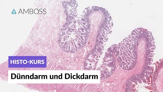 Histologie Dünndarm und Dickdarm  Mikroskopische Anatomie  AMBOSS Video [upl. by Chen713]