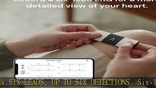 KardiaMobile 6Lead Personal EKG Monitor – Six Views of The Heart – Detects AFib and Irregular Arrh [upl. by Dlanar]