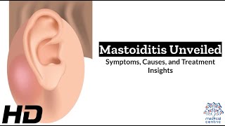 Mastoiditis The Hidden Danger Behind Ear Infections [upl. by Yenatirb422]