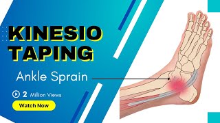 How to treat an Ankle Inversion Sprain  Kinesiology Taping to stabilise ligaments [upl. by Nothsa]