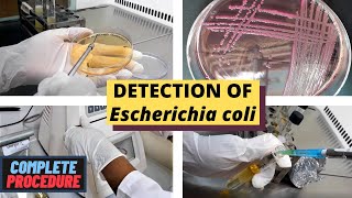 Detection of Escherichia coli E coliA Complete Procedure ISO 93081 amp ISO 16649 [upl. by Welcher]