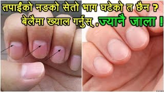 तपाईंको नङको सेतो भाग कस्तो छ  How Your Nails Give You Warning Signs And Alert About Your Health [upl. by Jochebed]