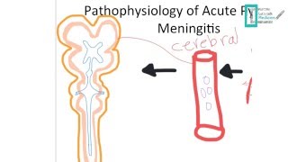 Meningitis Part 1 [upl. by Marelda515]